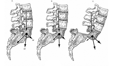 什么原因?qū)е铝思怪?>
					</div>
					<div   id=